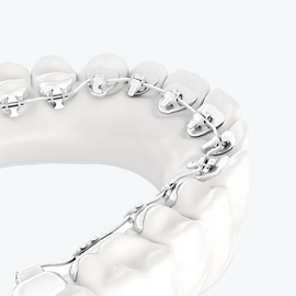 Die innenliegende Zahnspange ist ein attraktives Behandlungsmittel und eine unsichtbare Möglichkeit der Therapie