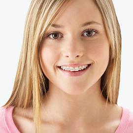 Bild eines Mädchens mit festsitzender Zahnspange